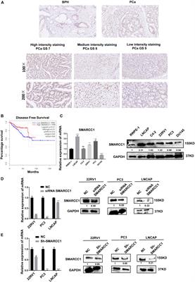 SMARCC1 Suppresses Tumor Progression by Inhibiting the PI3K/AKT Signaling Pathway in Prostate Cancer